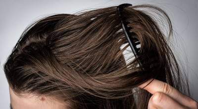 Rambut berminyak? Lakukan Perawatan Ini